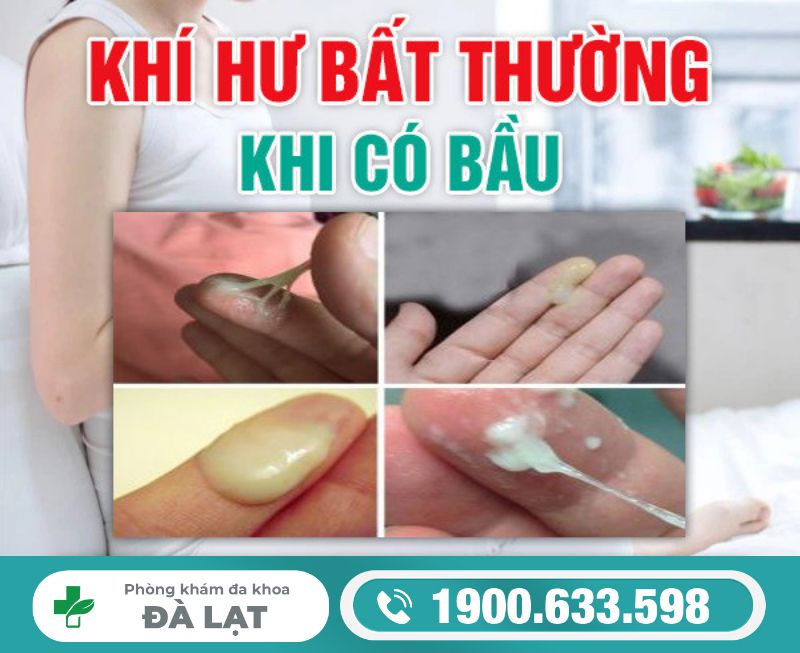 Hình ảnh minh họa